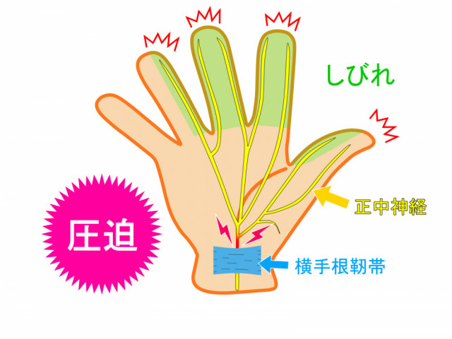 正中神経