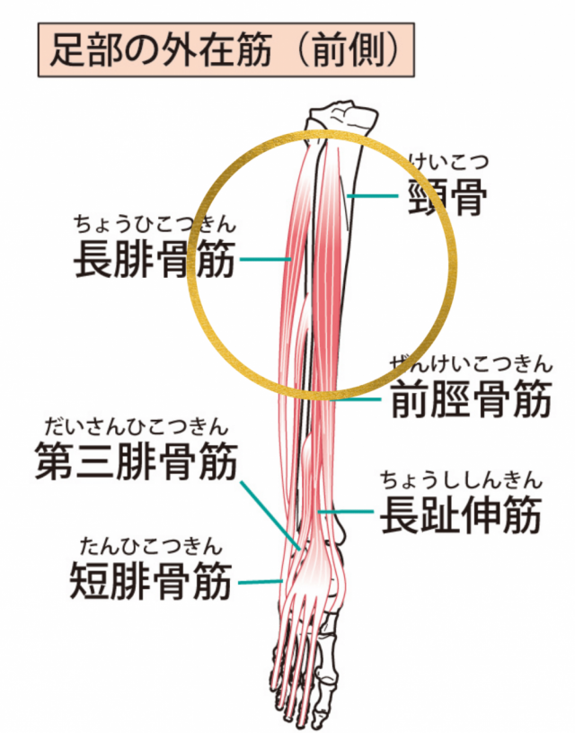 シンスプリントの画像