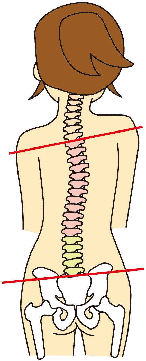 身体のゆがみ