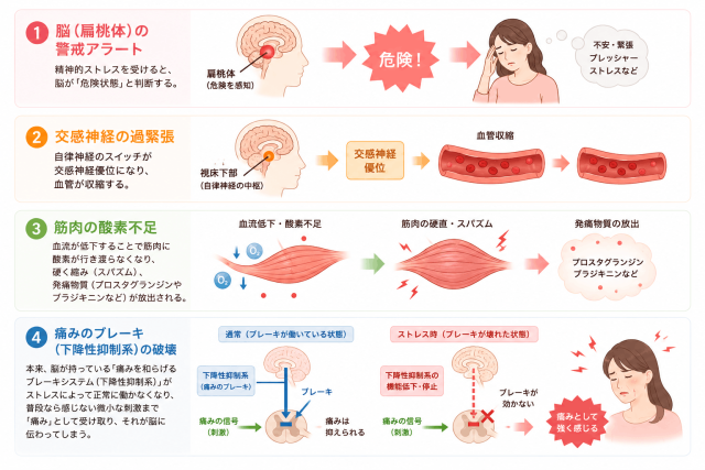 精神的・身体的・化学的ストレスが体に蓄積する器（ストレスバケット）のイメージ図｜よこはま山手治療院」